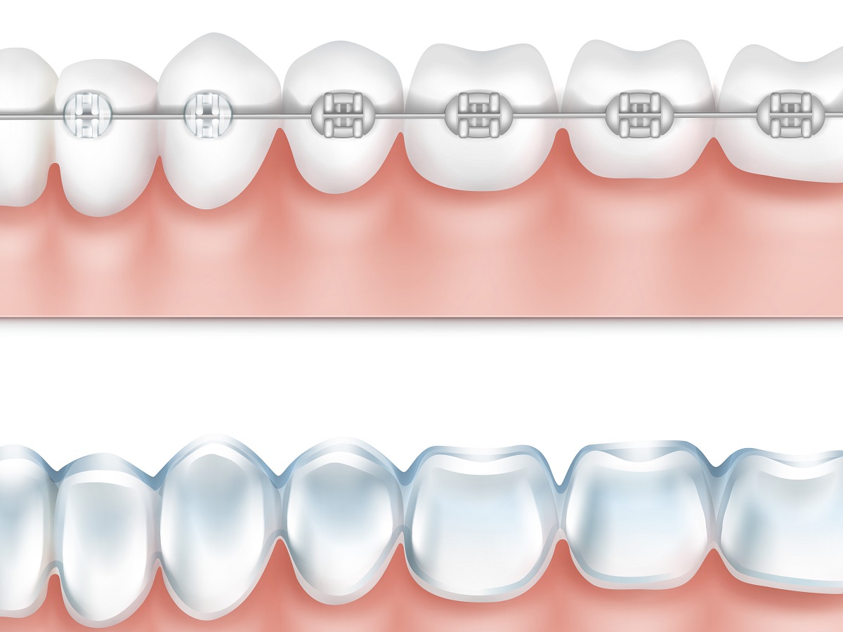 Best Female Dentist in Gwalior